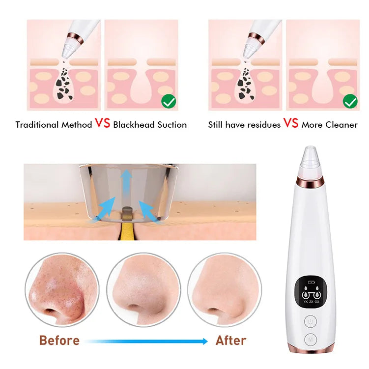 Removedor de Cravos Elétrico Aspirador Limpeza de Acne Remoção de Manchas Negras Limpeza Facial Profunda Máquina de Limpeza de Poros Ferramentas de Cuidados com a Pele