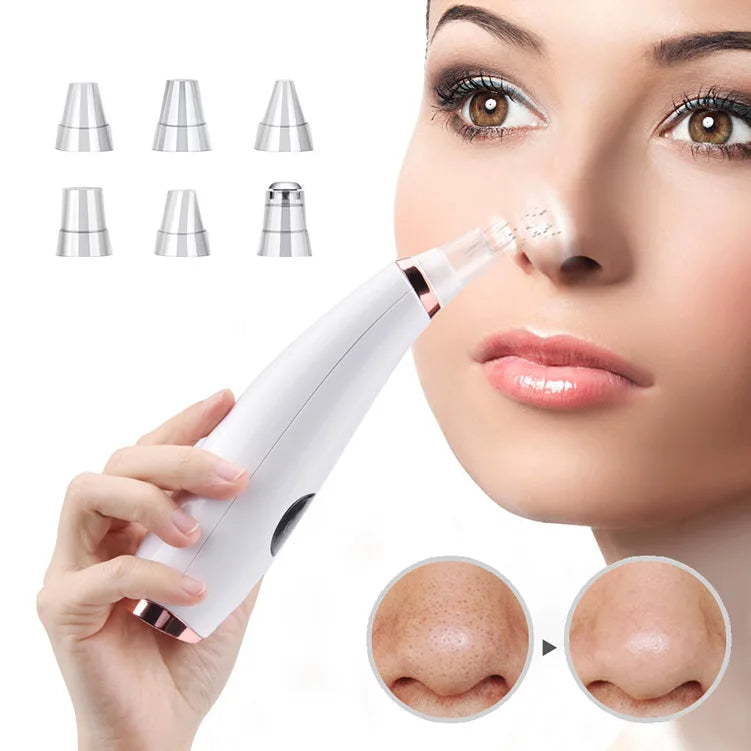 Removedor de Cravos Elétrico Aspirador Limpeza de Acne Remoção de Manchas Negras Limpeza Facial Profunda Máquina de Limpeza de Poros Ferramentas de Cuidados com a Pele